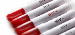 Итоги по заболеванию ВИЧ-инфекцией в 2018 году