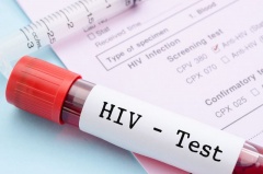 Итоги по ВИЧ-инфекции за 9 месяцев